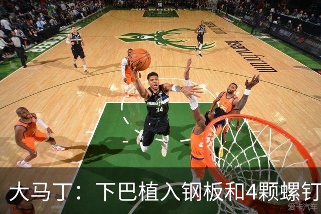 大马丁：下巴植入钢板和4颗螺钉，现在只能吃流食